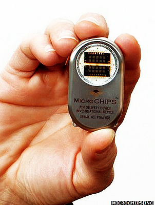 Microcipul implantat în oameni a trecut de primul test - Comentarii: 3